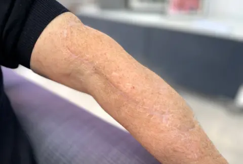 Surviving the Shark: Peter Smith's Terrifying Encounter and Recovery Journey