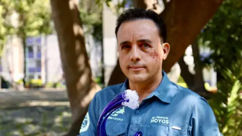 'This animal spared my life': Biologist bitten in head by shark hopes to meet it again