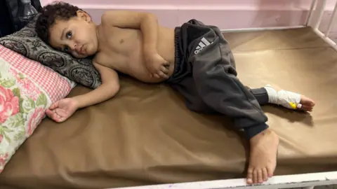 Children in Gaza Await Urgent Medical Evacuations Amidst Ceasefire