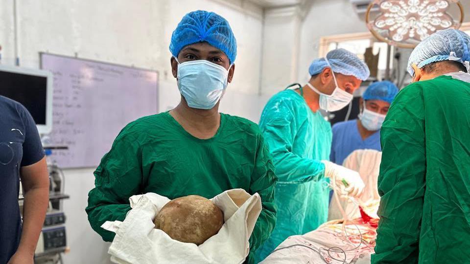 Sri Lanka’s Largest Recorded Bladder Stone Removed – 3.1 kg “Medical Record"